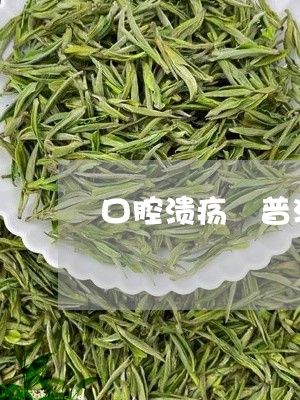 口腔溃疡 普洱茶/2023031666948